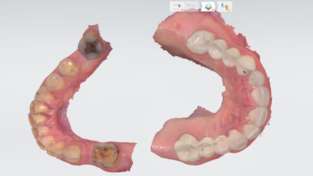 Korony i mosty Korony i mosty